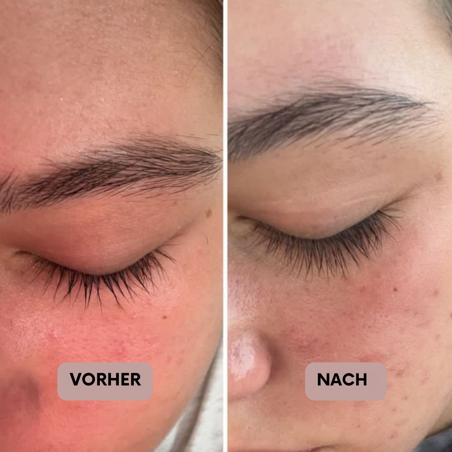 Ombreah™ Wimpernwachstum Serum